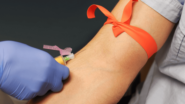 A arm during a blood draw