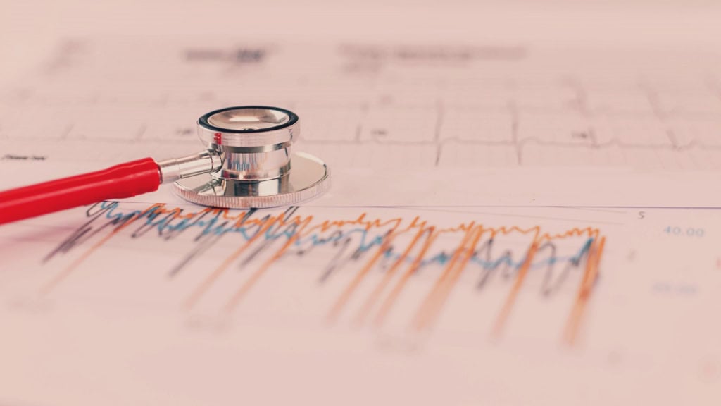A stethoscope on top of a piece of paper showing heart rate